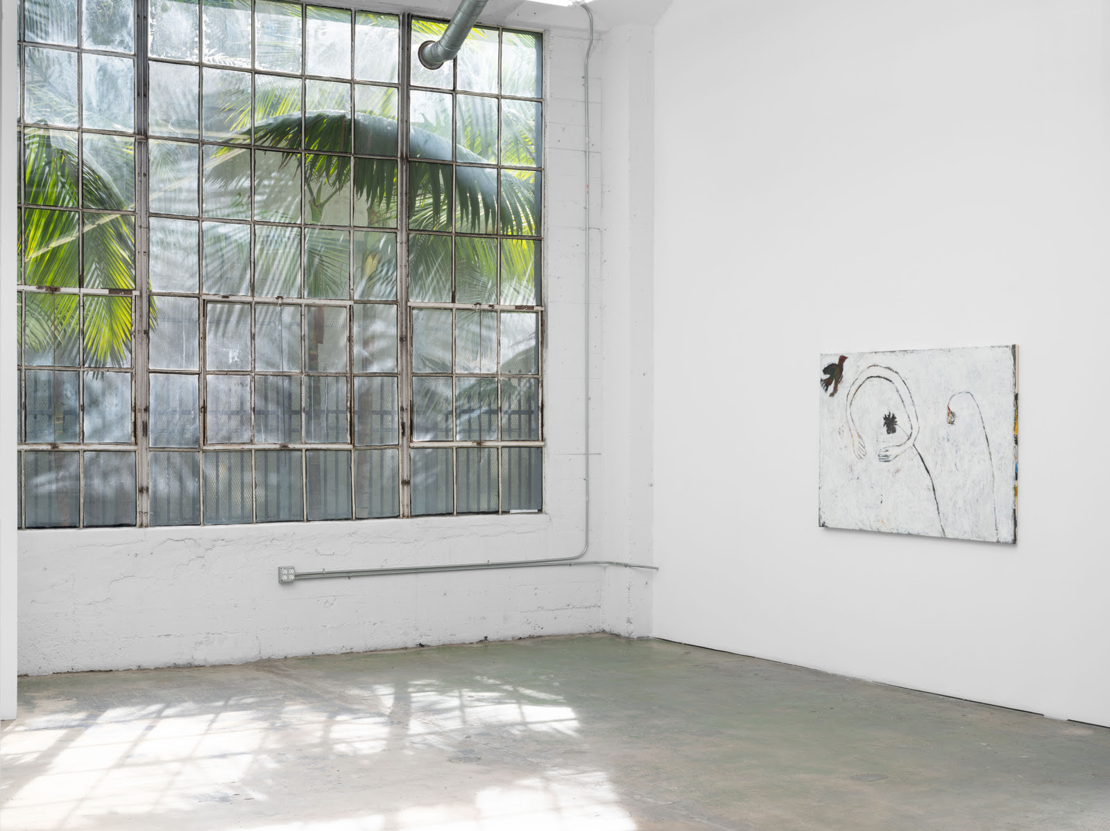 June Canedo de Souza, All Top Teeth Knocked Out at Once at Nicodim, photo 3