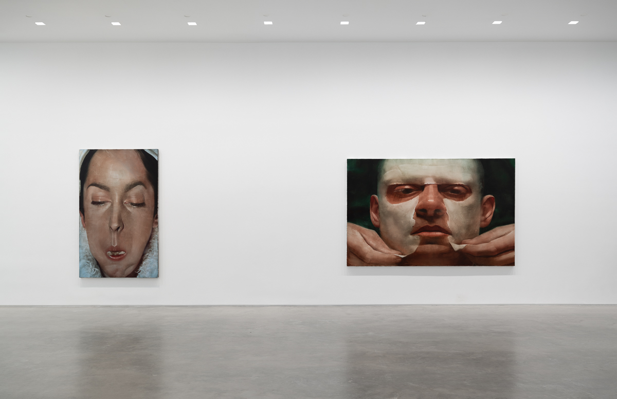 Joseph Yaeger, Agita at Gladstone, photo 4