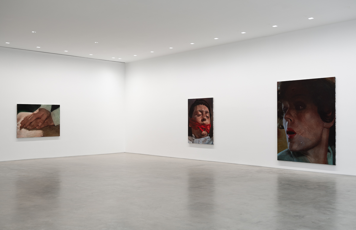 Joseph Yaeger, Agita at Gladstone, photo 7